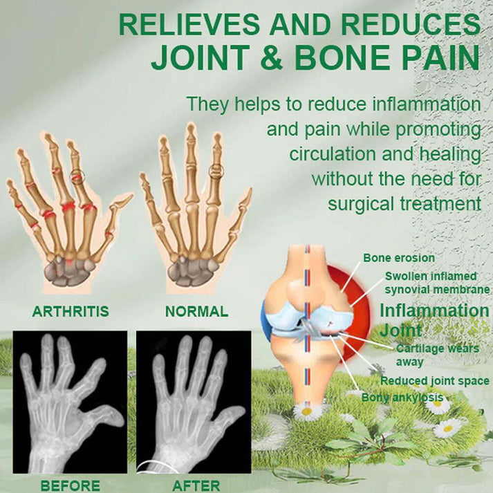 Bee Therapy™ Bee Venom Joint &amp; Bone Therapy Cream (Pack of 2)
